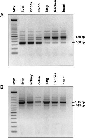 Alternative splicing in the LEAP-2 gene. 