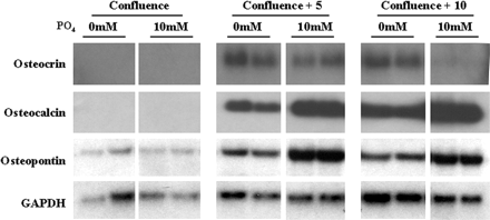 Osteocrin is expressed during osteoblast matrix production and maturation.