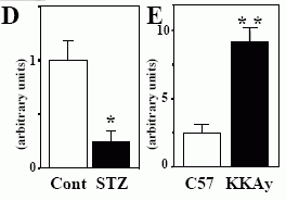 Musclin mRNA expression in insulin-deficient STZ mice.