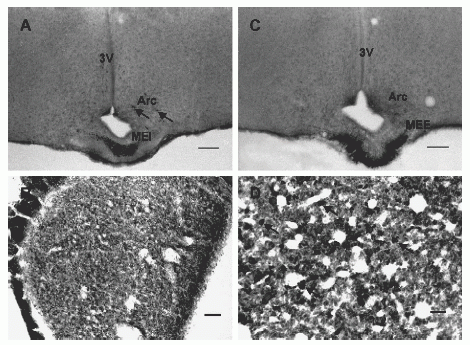 Photomicrographs of sections through the rat hypothalamus and pituitary labeled with NPB antiserum.