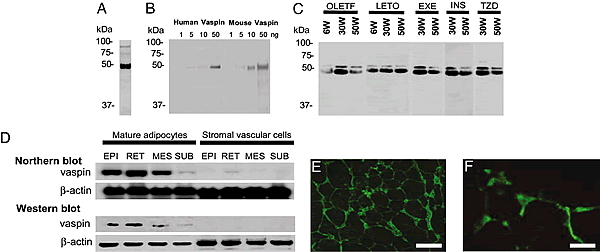 Expression of vaspin in 293T cells, adipocytes, and stromal vascular cells.