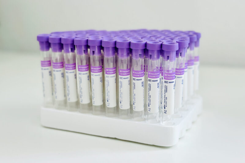 Lavender Vacutainer Tubes